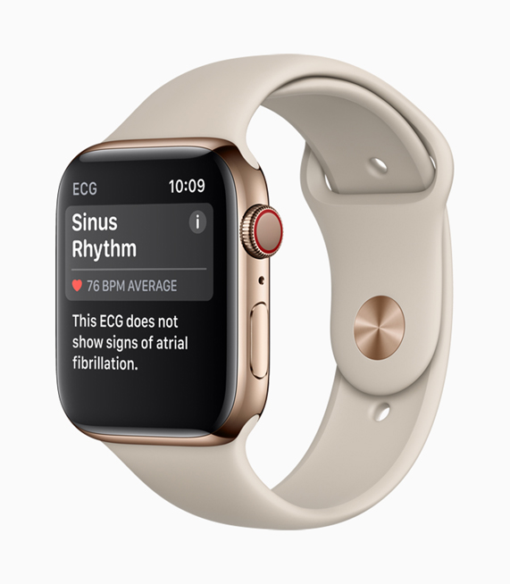 Apple Watch Series 4 屏幕显示出窦性心律的检测结果。